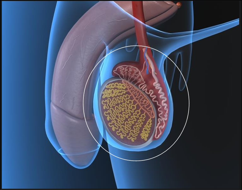 Cáncer De Testiculo Anku La Clinica Del Hombre