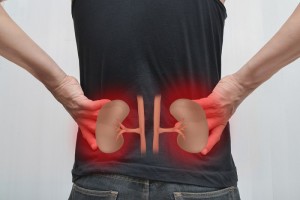 Kidney Stones; Renal Calculi; Urinary Stones
